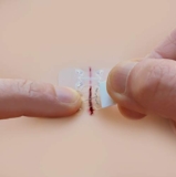 microMend, Bandaids That Work Like Stitches