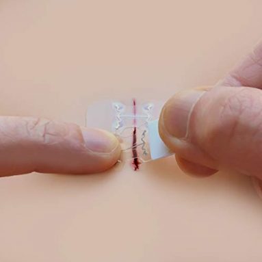 microMend, Bandaids That Work Like Stitches